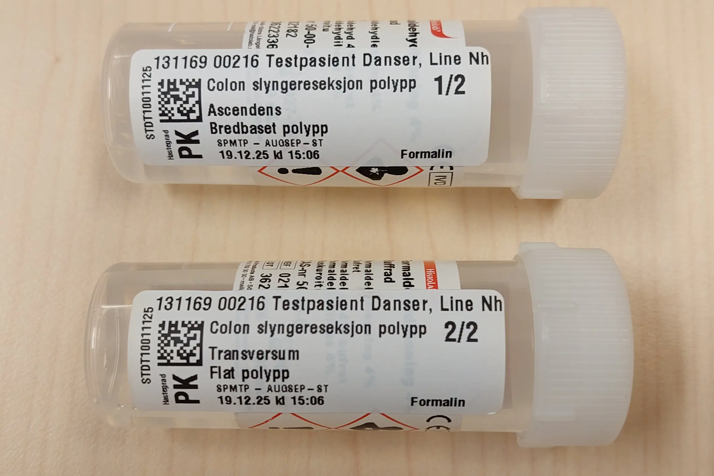 To beholder-etiketter