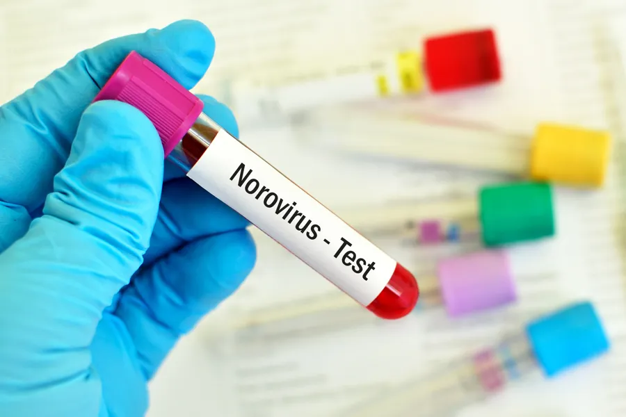 Illustrasjon: Test av norovirus