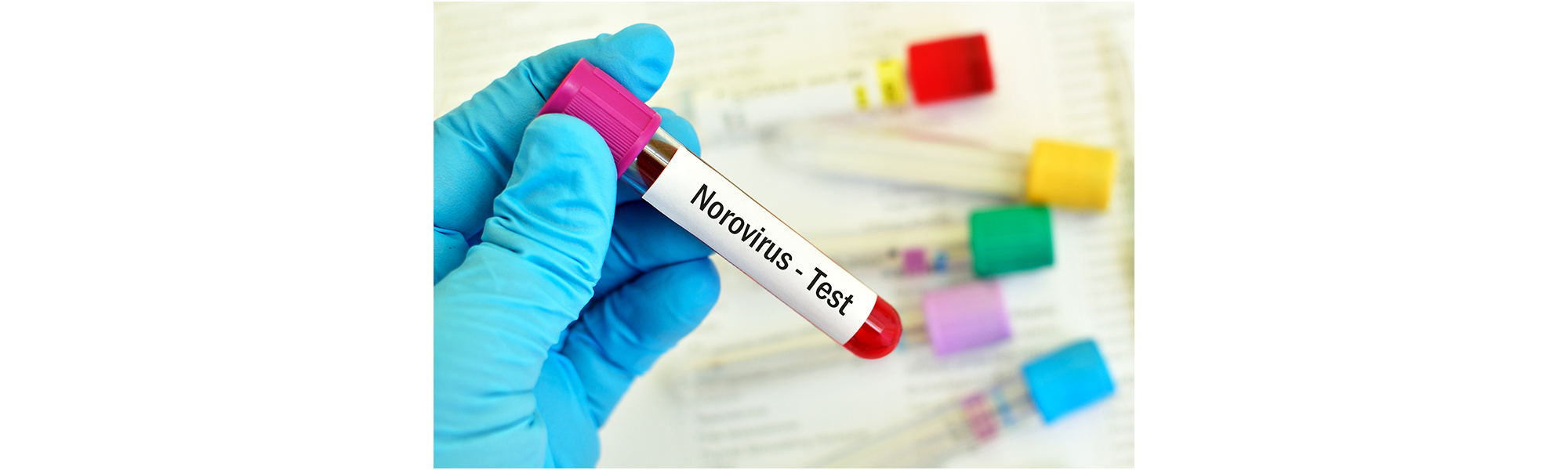 Bilde av en  Norovirus-test