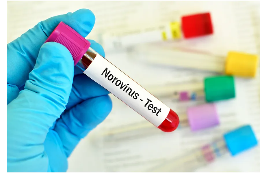 Bilde av en Norovirus-test