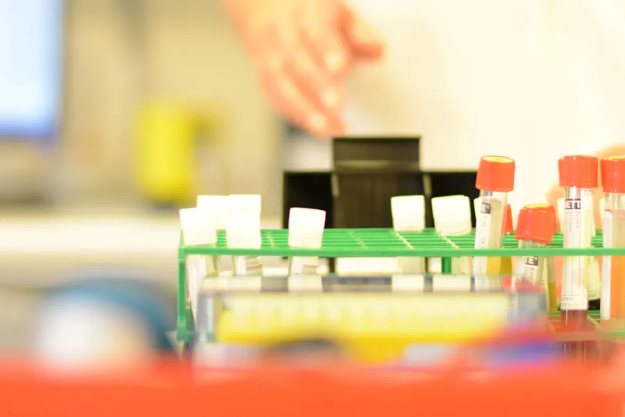 Et nærbilde av et leketøy