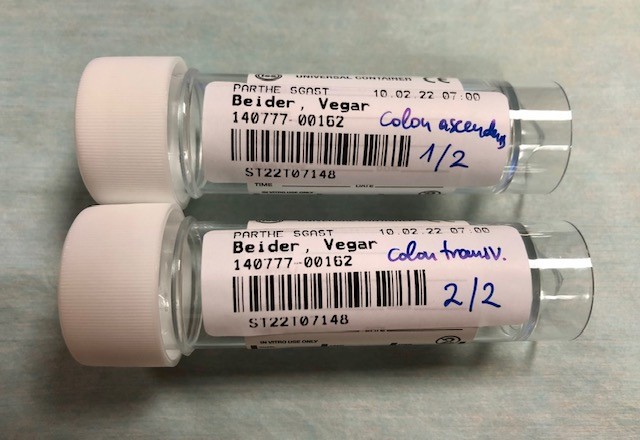 Bilde av beholdere med rikitg merking